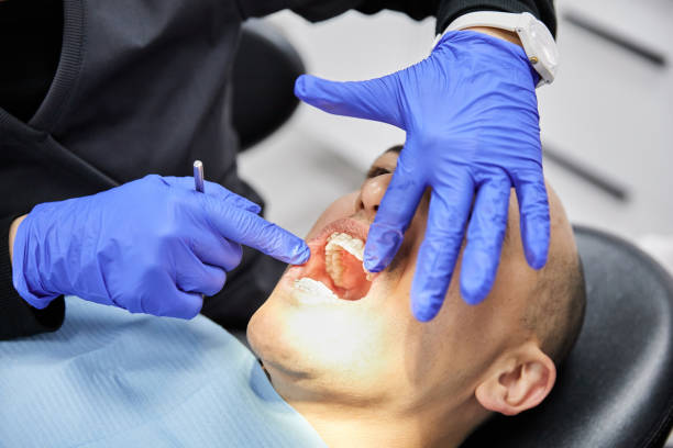 Best Broken or Chipped Tooth Repair in Fayetteville, GA