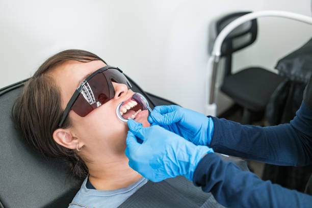Best Emergency Wisdom Tooth Extraction in Fayetteville, GA